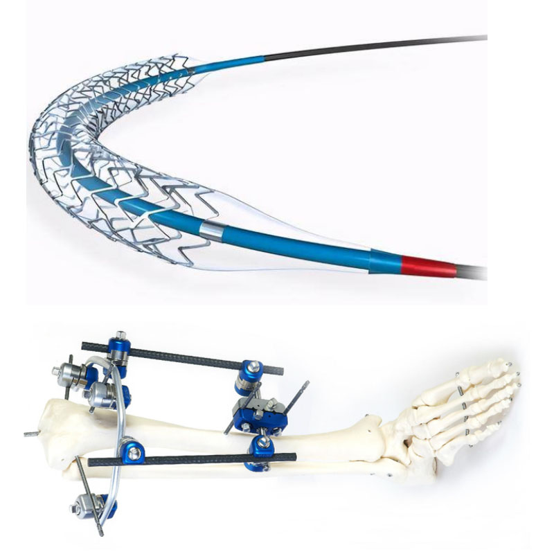 Moulure de stent médical